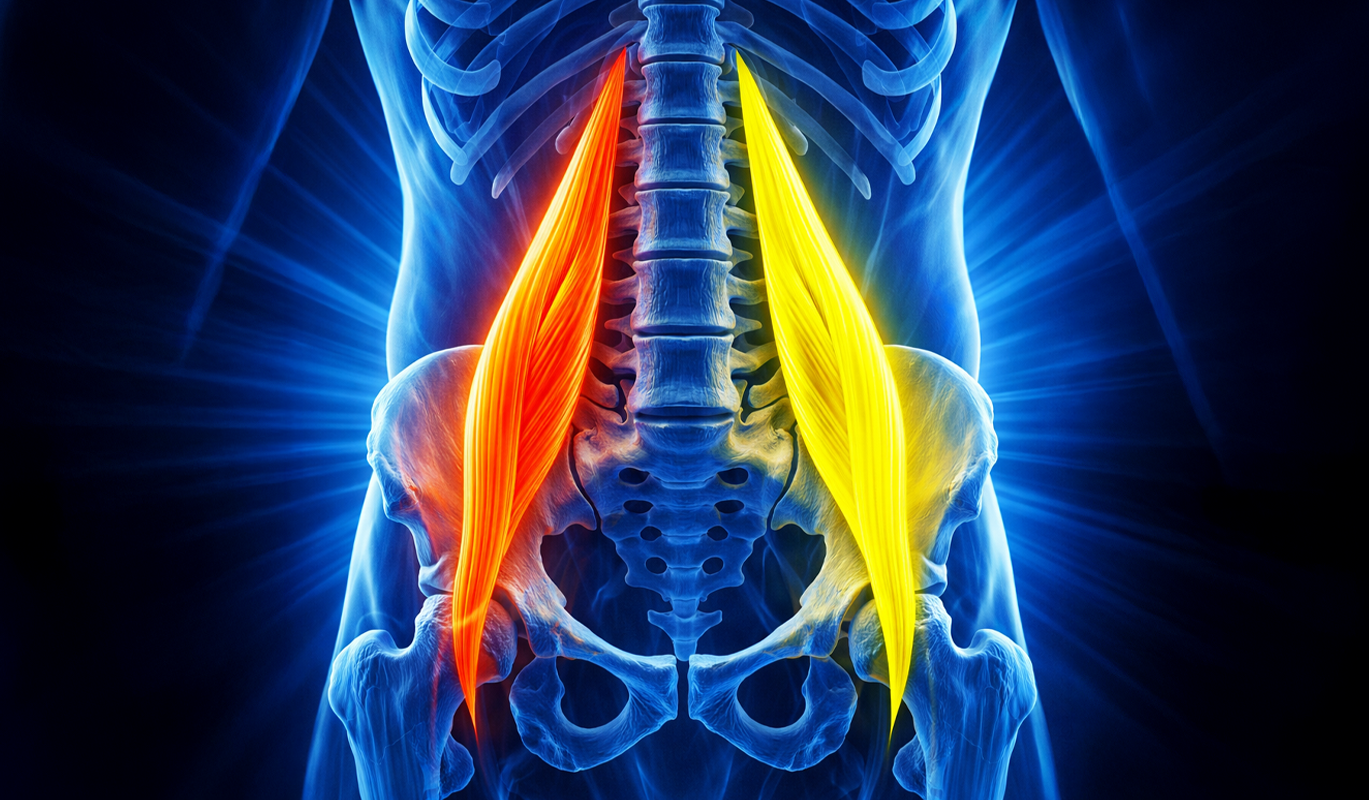 Douleur psoas gauche ou droit : faut-il s’inquiéter ?
