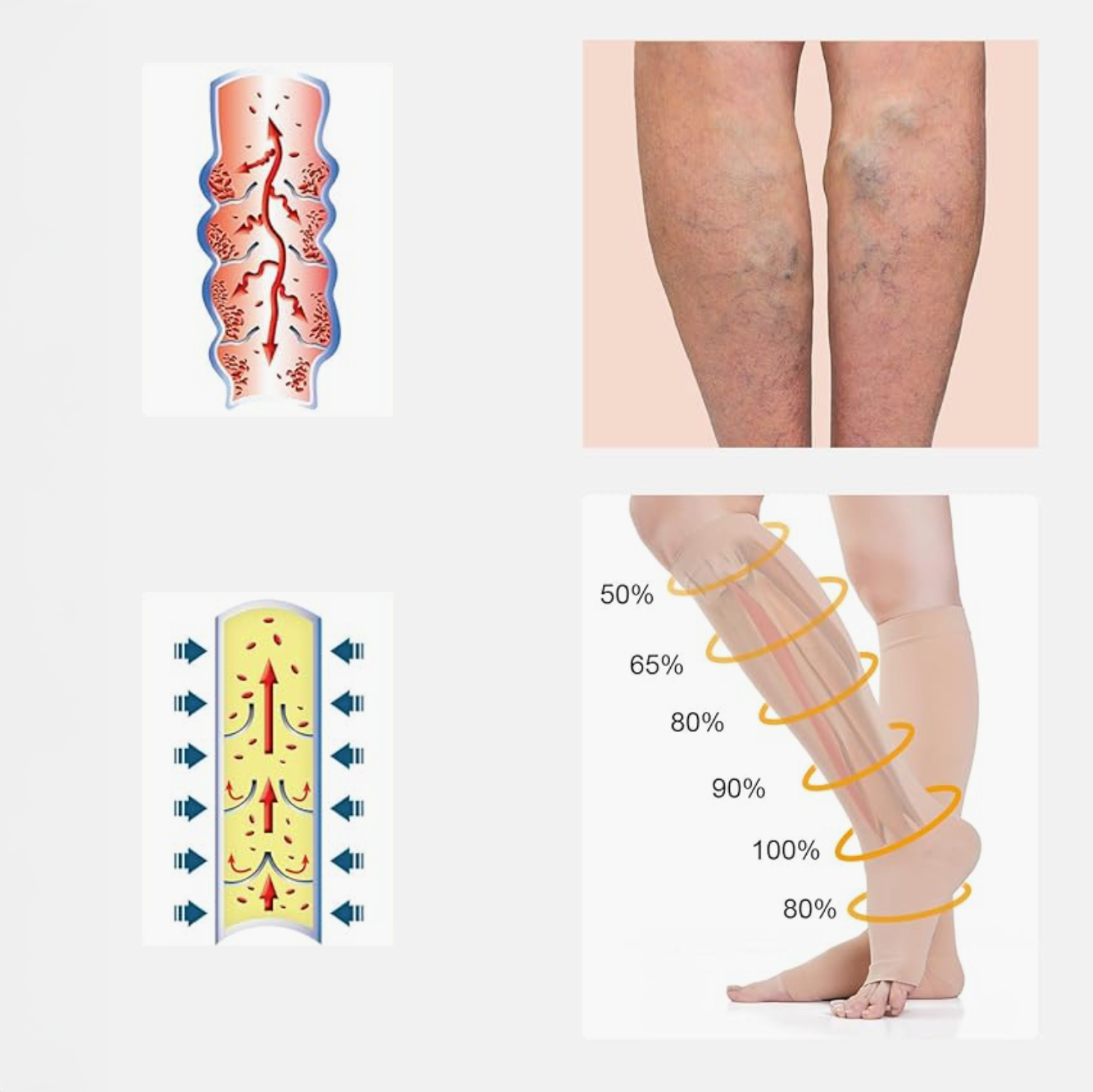 Bas de contention à bouts ouvert (Niveau 2)